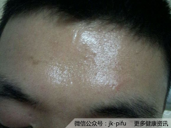醋只能用來炒菜?你OUT啦!白醋護膚秘方揭秘