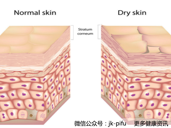 皮膚干燥？小心變成“黃臉婆”！