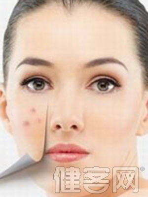 生理期調理肌膚 有效去除各種皮膚問題