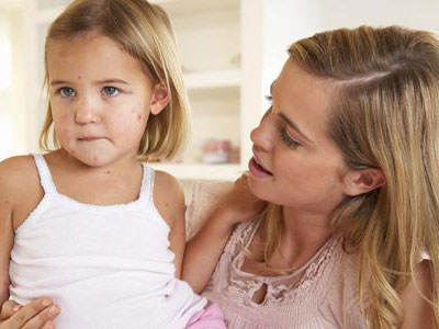 八個月孩子易患荨麻疹
