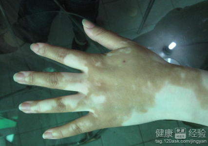 第1步