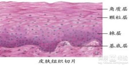 白癜風的臨床表現及治療