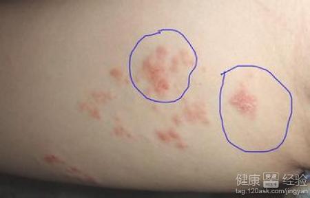 第1步