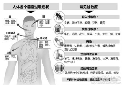 急性荨麻疹治療要點有什麼