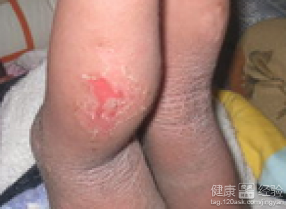 第1步