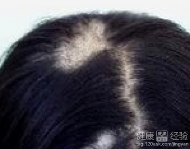 第2步