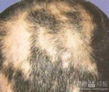 第3步