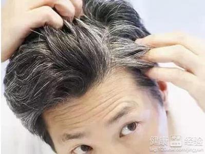 防止長白頭發的6種方法