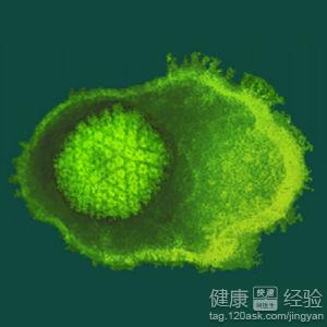 病毒性帶狀疱疹兩大治療要點