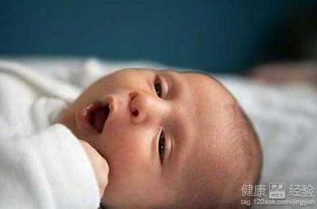 二十個月的寶寶患上脂溢性皮炎怎麼辦