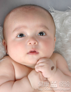 如何治療嬰兒濕疹？