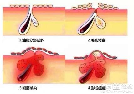 第1步