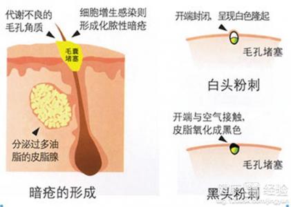 第4步