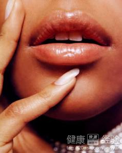 唇部固定性藥疹引起的色素沉積如何去除呢