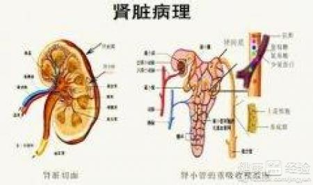 紫癜性腎炎能活多久