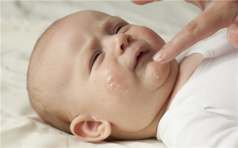 嬰兒濕疹要如何治療 如何治療嬰兒濕疹 嬰兒患上濕疹怎麼辦