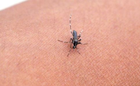 被蚊子咬到後的去癢方法有哪些 被蚊子咬後如何止癢 蚊子叮咬後的止癢方法